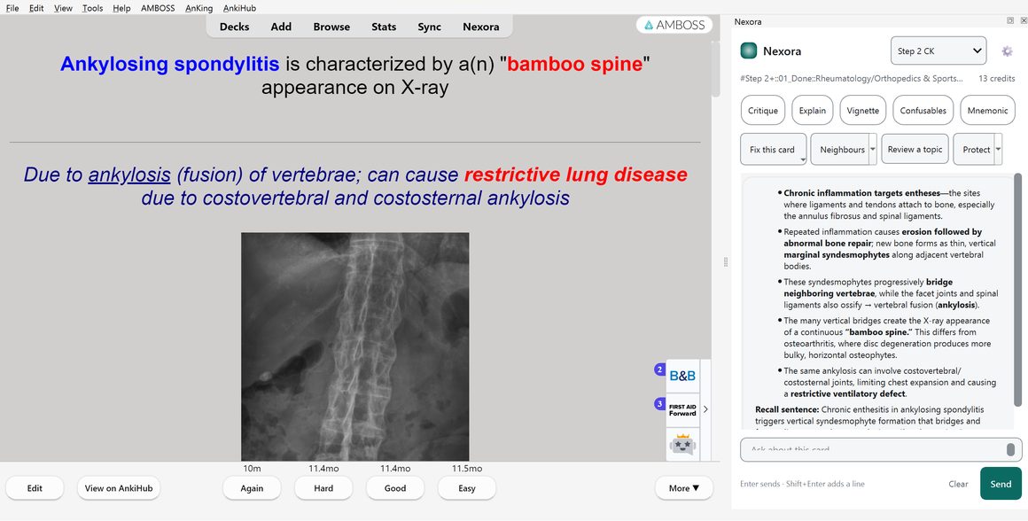 Anki showing a cloze card about ankylosing spondylitis, with the Nexora panel open beside it explaining the mechanism behind the bamboo spine appearance.